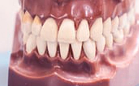 牙齦出血怎么辦-牙齦出血怎么預(yù)防