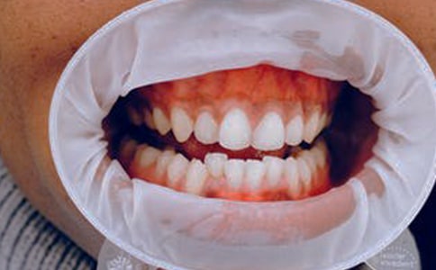 ��ǻ��(zh��)�I(y��)�����t(y��)�����c(di��n)���������l�R�������f(shu��)��